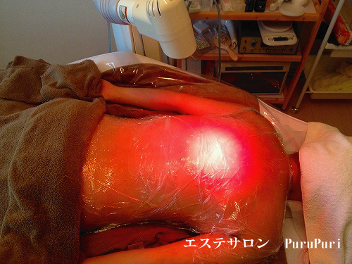 �o�b�N�g���[�g�����g