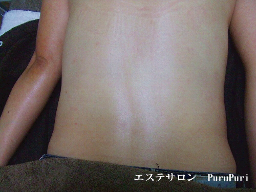 �o�b�N�g���[�g�����g