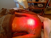 �o�b�N�g���[�g�����g