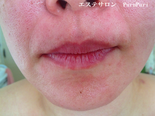 ��؃}�b�T�[�W2