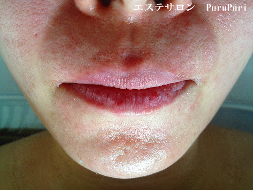 ��؃}�b�T�[�W2