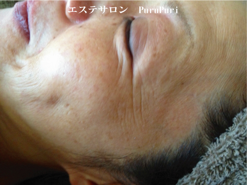 ��؃}�b�T�[�W�{�p�O