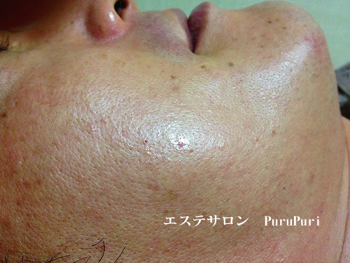 �Y�_�p�b�N�{�p��