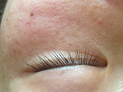 �v���Y�}�ډ�